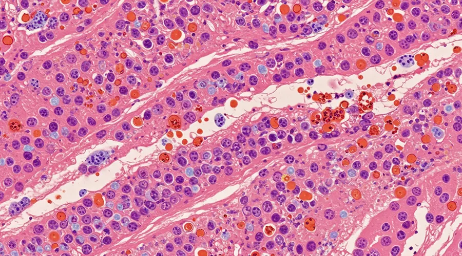 كيف ينتقل فيروس FIP بين القطط؟